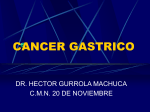 Cancer Gastrico EPIDEMIOLOGIA