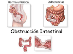 Obstrucción Intestinal