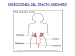 Infecciones del tracto urinario