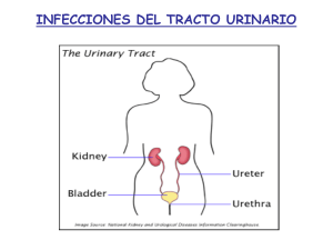 Infecciones del tracto urinario