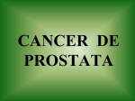 CANCER DE PROSTATA - sau