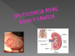 insuficiencia renal aguda y cronica