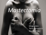 mastectomia