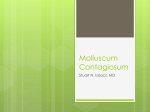 Molluscum Contagiosum