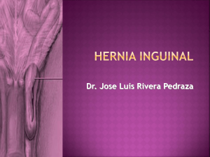 Hernia inguinal: enfoque general