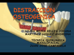 DISTRACCION OSTEOGENICA