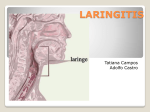 Laringitis