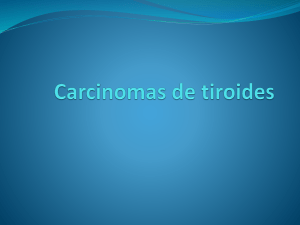Carcinomas de tiroides