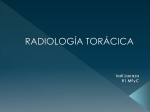 radiología torácica
