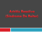 Artritis Reactiva (Síndrome De Reiter)