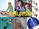 epilepsia - bloquesnecesidades