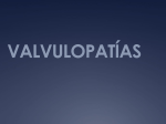 valvulopatías - MOP-UNAB