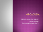Hipoacusia súbita