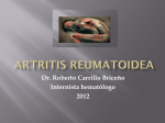Artritis Reumatoidea