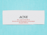 ACNE - medicina