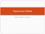 Hipoacusia Subita