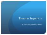 Tumores hepaticos - medicina