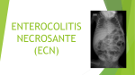 enterocolitis necrosante