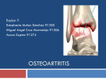 Artrosis en articulaciones especificas