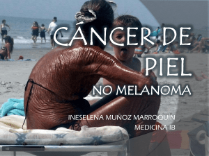 CÁNCER DE PIEL- No Melanoma
