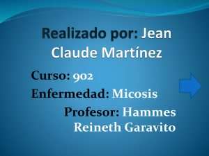 Nombre: Jean Claude Martínez