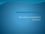 mononucleosis infecciosa