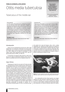 Otitis media tuberculosa