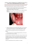 Lesiones y tumores benignos de la cavidad bucal. Artículo a raíz del