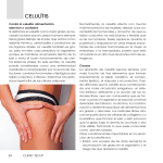 celulítis - clinic tech rf