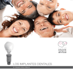 Los Implantes Dentales - Clínica Eduardo Anitua
