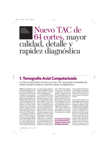 Nuevo TAC de 64 cortes, mayor calidad, detalle y rapidez diagnóstica