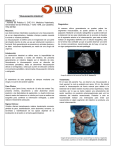 “Intususcepción intestinal” Hidalgo, M.1. 1 Alumna de Práctica II