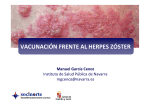 Vacuna Herpes Zoster