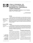 LóbuLo piRamidaL de La gLánduLa tiRoides