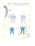 como se produce el deterioro de los dientes