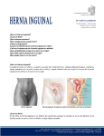 ¿Qué es la hernia inguinal? - coloproctologia