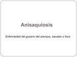 Anisaquiosis