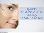 toxina botulínica en la clínica odontológica
