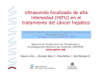 Ultrasonido focalizado de alta intensidad (HIFU) en el tratamiento