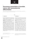 Uncommon presentation of prostate cancer with neuroendocrine