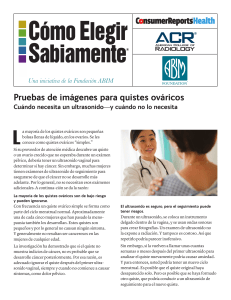 Pruebas de imágenes para quistes ováricos