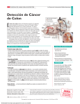 Detección de cáncer de colon