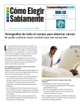 Tomografías de todo el cuerpo para detectar cáncer