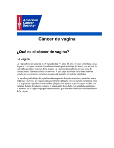 Cáncer de vagina - American Cancer Society