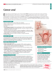 Cáncer anal - BlueAppleCare