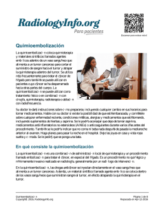 Quimioembolización - RadiologyInfo.org
