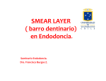 SMEAR LAYER ( barro dentinario) en Endodoncia.