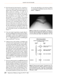 4) Mal alineamiento femoropatelar: se puede va