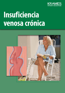 Insuficiencia venosa crónica