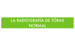 LA RADIOGRAFÍA DE TÓRAX NORMAL